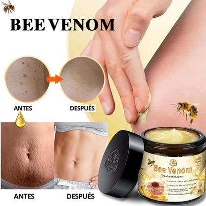 Crema Veneno de Abeja – Reduce Manchas y Cicatrices, Rejuvenece la Piel