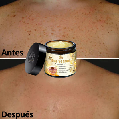 Crema Veneno de Abeja – Reduce Manchas y Cicatrices, Rejuvenece la Piel
